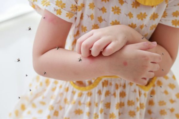 Dengue Fever In Children | All You Need To Know